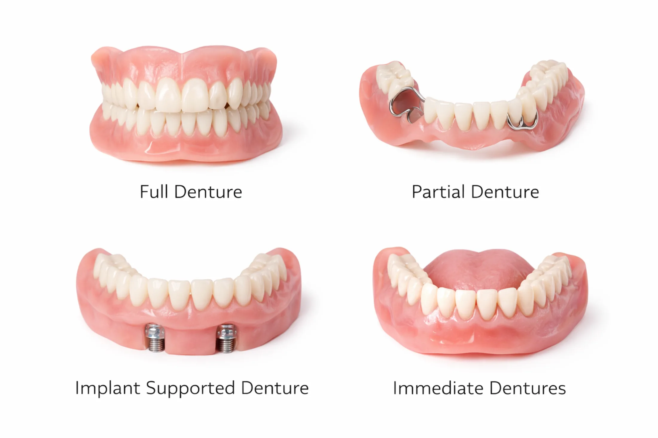 Types of dentures at Rozenberg Dental NYC: full, partial, implant-supported, and immediate dentures