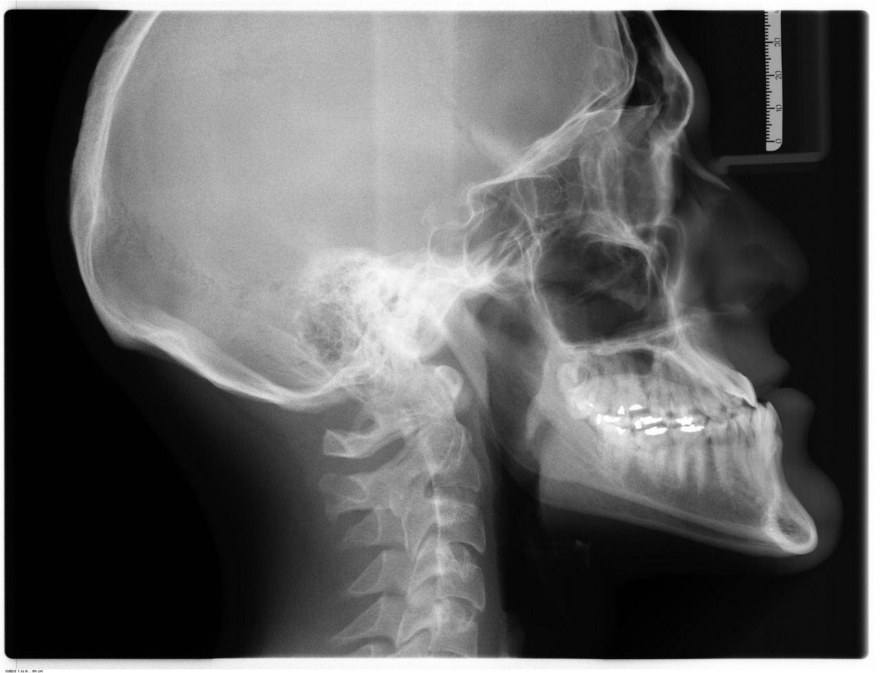 Low-radiation digital dental x-rays at Rozenberg Dental, Midtown NYC