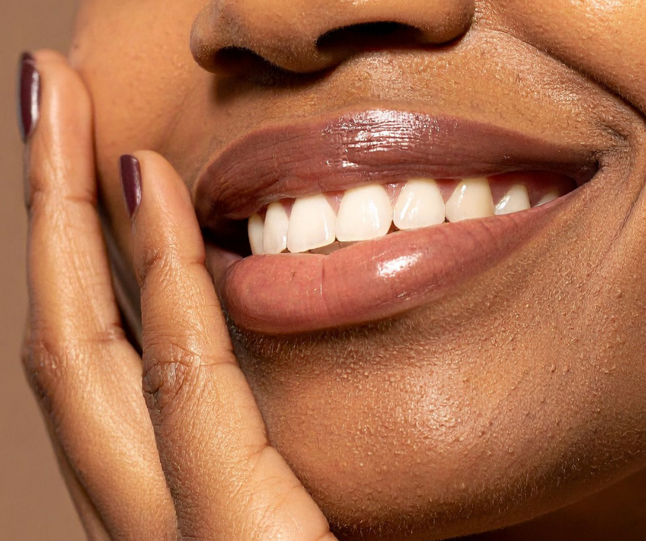 Bright shiny teeth woman smiling